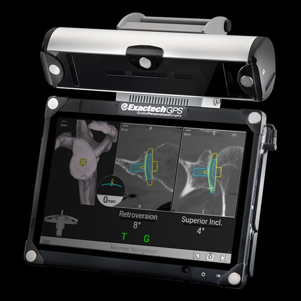 ExactechGPS Shoulder Application - shoulder navigation technology for shoulder replacement surgery