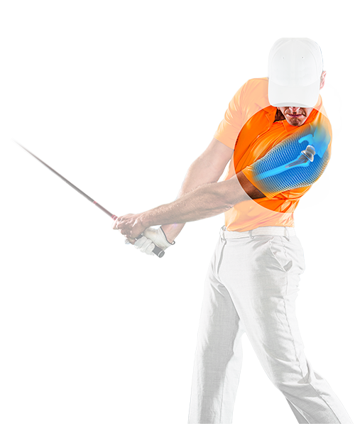 Exactech Shoulder Replacement