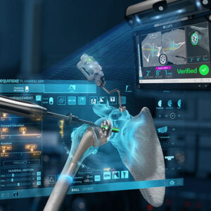 Exactech Active Intelligence