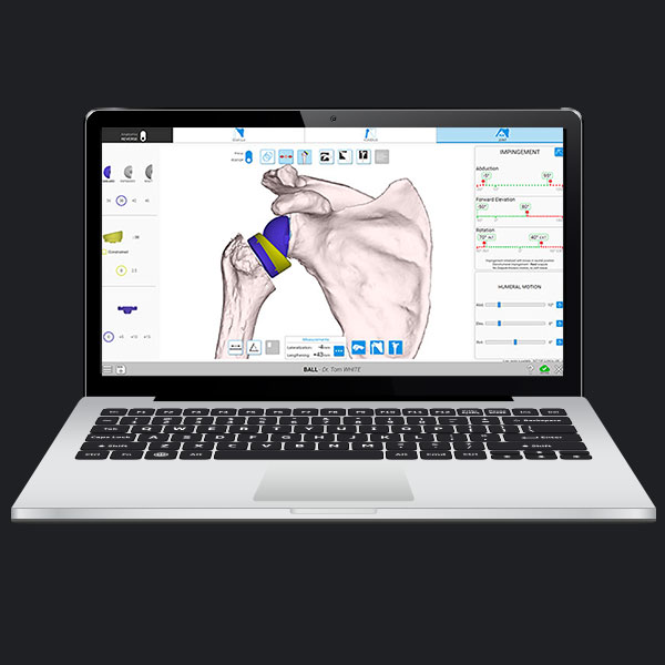 Exactech Shoulder Equinoxe Planning Application